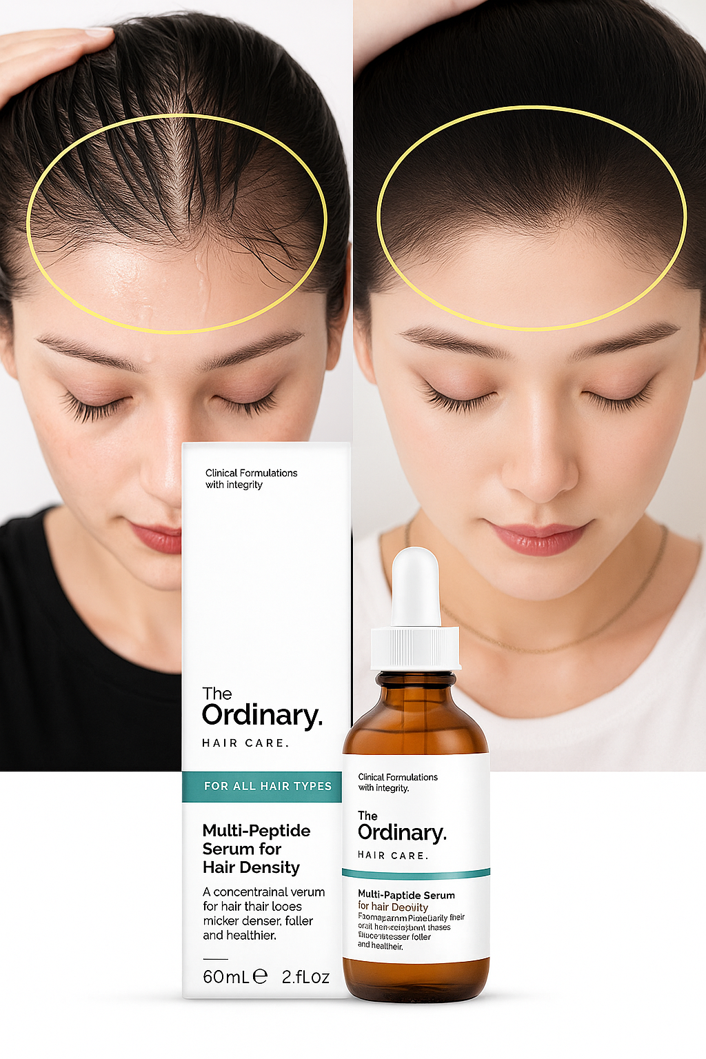The Ordinary  –  Serum Multipeptide para Densidad Capilar 💁‍♀️ + Entrega Gratis + Paga al Recibir